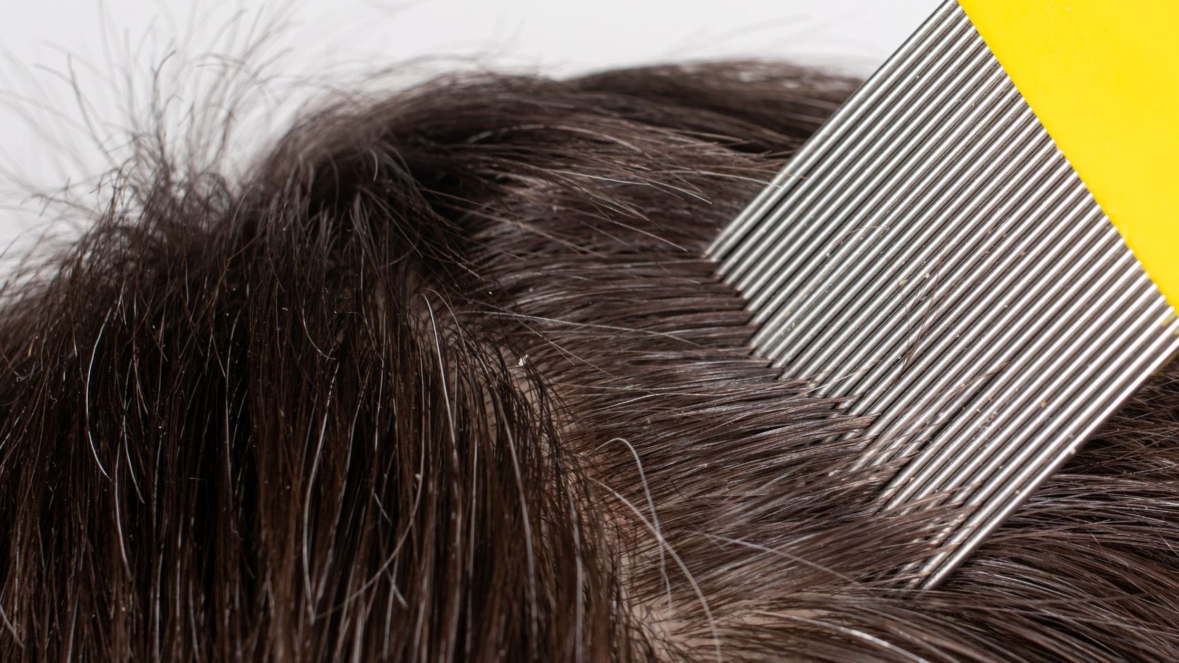 Lice Clinics Arizona